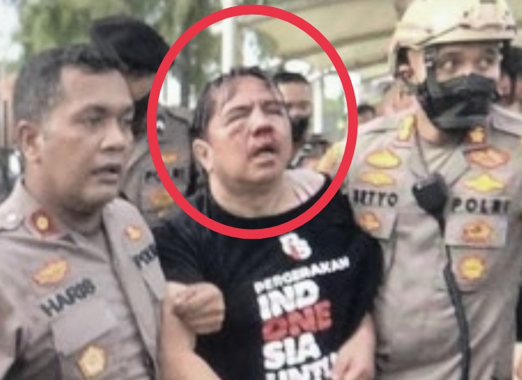 Ini Profil dan Rekam Jejak Armando, Pakar Komunikasi yang Dipukul saat Demo 11 April 2022