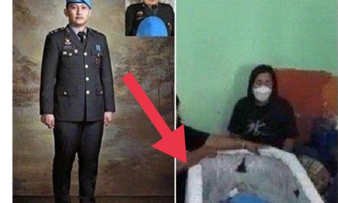 Akhirnya Terbongkar Luka Sayatan di Tubuh Brigadir J, Begini Penjelasan dari Ahli Forensik