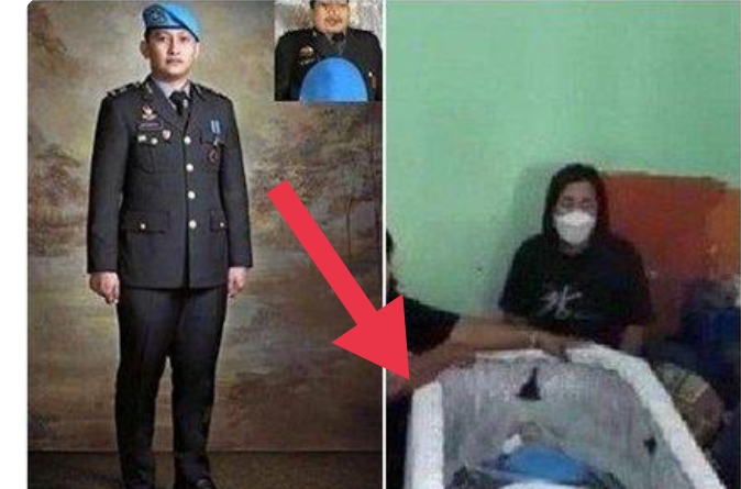 Ini Kata Dokter Forensik Soal Brigadir J Ditarik Pakai Tali hingga Ada Luka Lilitan di Leher