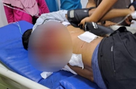 Detik-detik Relawan Prabowo-Gibran Ditembak OTK, Polisi Langsung Buru Sosok Ini